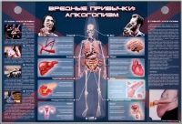 Электрифицированный стенд "Вредные привычки: алкоголизм" - «globural.ru» - Чапаевск