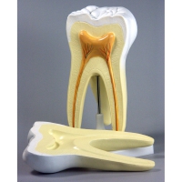 Модель "Строение зуба" - «globural.ru» - Чапаевск