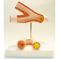 Модель "Здоровые и поврежденные сосуды"	 - «globural.ru» - Чапаевск