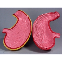 Модель Желудок в разрезе - «globural.ru» - Чапаевск