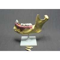 Модель "Челюсть разборная" - «globural.ru» - Чапаевск