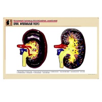 Рельефная таблица "Почка. Фронтальный разрез" (формат А1, матовое ламинир.) - «globural.ru» - Чапаевск